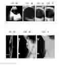 Fig. 02 - Methods for diagnosing vitreo-retinal disease