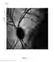 Fig. 02 - Method for detecting a disease by analysis of retinal vasculature