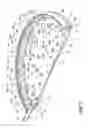 Fig. 06 - Surgical light with beam redirecting optics