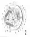 Fig. 13 - Surgical light with beam redirecting optics