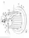 Fig. 02 - Recessed LED lighting fixture