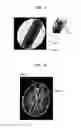 Fig. 09 - System and method for automatic planning of views in 3D images of brain