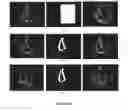Fig. 06 - Systems, methods and computer readable storage media storing instructions for automatically segmenting images of a region of interest