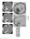 Fig. 07 - Magnetic resonance maps for analyzing tissue