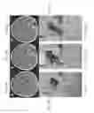 Fig. 09 - Magnetic resonance maps for analyzing tissue
