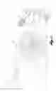 Fig. 03 - CHANNELIZER POST