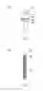 Fig. 09 - SCREW MADE OF HIGH-STRENGTH COMPOSITE MATERIAL AND HIGH-STRENGTH CAPPED SCREW MADE OF HIGH-STRENGTH COMPOSITE MATERIAL