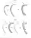 Fig. 08 - Assembly for Pitch Control System