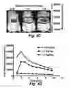 Fig. 05 - USE OF COELENTERAZINE FOR IMAGING INSULIN-GENERATING BETA-CELLS