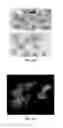 Fig. 09 - Polymeric depots for localization of agent to biological sites