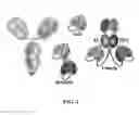 Fig. 02 - Immunoprotective primary mesenchymal stem cells and methods