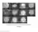 Fig. 05 - HDAC Inhibitor Polymorphic Forms and Methods of Use