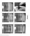 Fig. 02 - BIODEGRADABLE SUBCUTANEOUS IMPLANTS AND METHODS OF MAKING