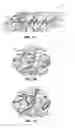 Fig. 02 - Bioactive porous bone graft implants