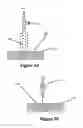 Fig. 02 - Methods for local drug delivery by microinjection
