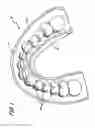 Fig. 02 - Antimicrobial solution for use with dental appliances