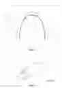 Fig. 02 - Archwire assembly with non-linear crimpable orthodontic stop and method of manufacture