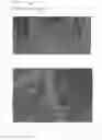 Fig. 45 - Registering shape data extracted from intra-oral imagery to digital reconstruction of teeth for determining position and orientation of roots
