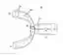 Fig. 01 - Apparatus and system for making dental impressions