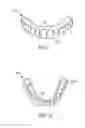 Fig. 02 - Dental devices and systems and methods for making the same