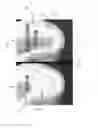 Fig. 02 - Method for conducting a guided sinus lift procedure