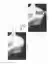 Fig. 03 - Method for conducting a guided sinus lift procedure