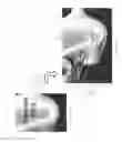 Fig. 04 - Method for conducting a guided sinus lift procedure