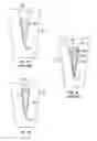 Fig. 02 - MULTI-TAPER DENTAL ROOT CANAL FILLING POINTS/CONES AND PROCESS OF MAKING SAME