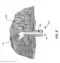 Fig. 05 - ROOT CANAL FOR TISSUE IN-GROWTH