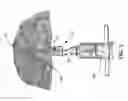 Fig. 06 - ROOT CANAL FOR TISSUE IN-GROWTH