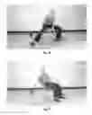 Fig. 28 - METHOD FOR RELIEVING PAIN AND A KIT THEREFOR