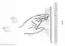 Fig. 04 - METHOD FOR TREATING NEUROLOGICAL IMPAIRMENT
