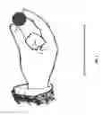 Fig. 06 - METHOD FOR TREATING NEUROLOGICAL IMPAIRMENT