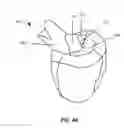 Fig. 06 - System and method for performing virtual surgery