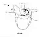 Fig. 09 - System and method for performing virtual surgery