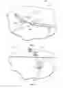 Fig. 06 - Methods, systems and kit for demonstrating medical procedure