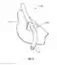 Fig. 07 - Methods, systems and kit for demonstrating medical procedure