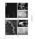 Fig. 09 - SUPER-RESOLUTION FLUORESCENCE LOCALIZATION MICROSCOPY