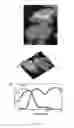 Fig. 10 - SUPER-RESOLUTION FLUORESCENCE LOCALIZATION MICROSCOPY