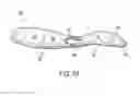Fig. 06 - Diagnostic test device with improved structure