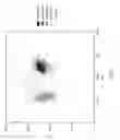 Fig. 02 - Reagents, systems and methods for analyzing white blood cells