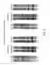 Fig. 04 - TRANSCRIPT OPTIMIZED EXPRESSION ENHANCEMENT FOR HIGH-LEVEL PRODUCTION OF PROTEINS AND PROTEIN DOMAINS