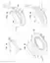 Fig. 10 - Protection structure for implantable connector and apparatus for manipulating same