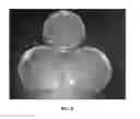 Fig. 06 - ANTIMICROBIAL TEXTILES AND METHODS FOR PRODUCTION OF THE SAME