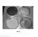 Fig. 07 - ANTIMICROBIAL TEXTILES AND METHODS FOR PRODUCTION OF THE SAME