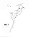 Fig. 02 - Exercise device