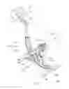 Fig. 02 - High knees exercise apparatus