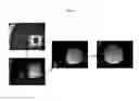 Fig. 05 - Engineered liver tissues, arrays thereof, and methods of making the same