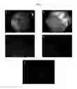 Fig. 11 - Engineered liver tissues, arrays thereof, and methods of making the same