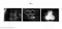 Fig. 12 - Engineered liver tissues, arrays thereof, and methods of making the same